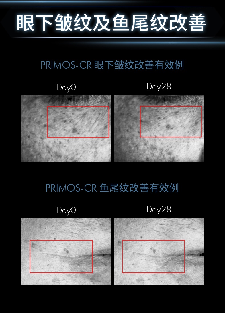 商品SkinCeuticals|修丽可 AGE紧致塑颜面霜 4ml*3 玻色因淡纹抗初老 抗糖修护,价格¥218,第10张图片详细描述