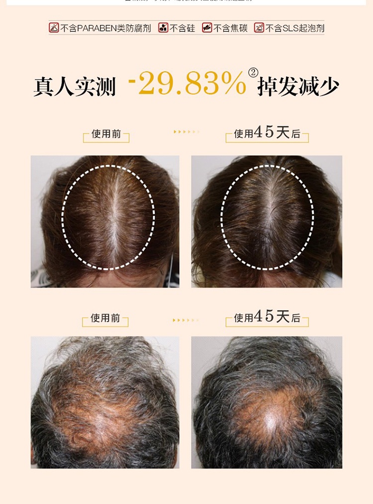 商品Leonor Greyl|Leonor Greyl玫瑰�精华活发油稳固强韧发根精华液20ml,价格¥216,第7张图片详细描述