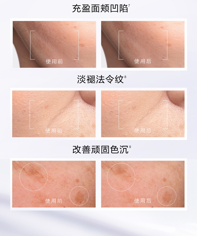 商品Lancôme|兰蔻 塑颜三管精华 3管精华 50ml 美白淡纹抗老化抗氧,价格¥937,第4张图片详细描述