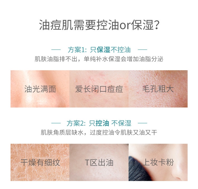 商品Avene|雅漾MAT乳控油保湿调理露40ML,价格¥169,第10张图片详细描述