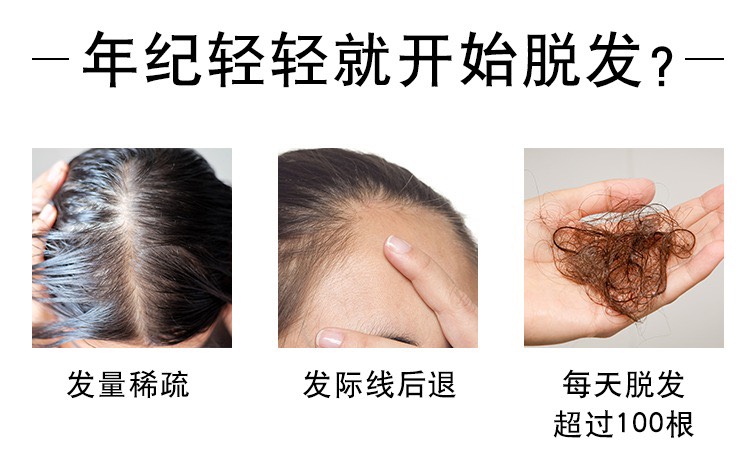 商品Vichy|Vichy薇姿DERCOS防脱固发头皮护理安瓶精华液6mlx21 男版,价格¥459,第3张图片详细描述