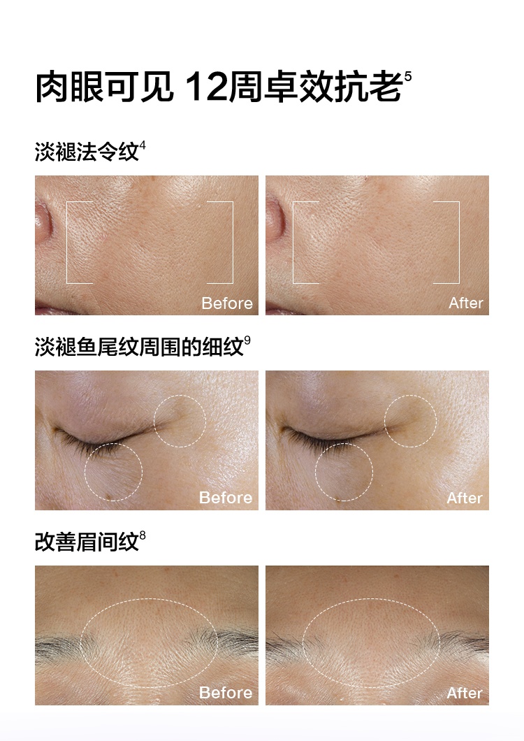 商品【原封正品】 Clinique|CLINIQUE 倩碧 智慧专研修护精华紫光瓶抗老精华 30/50/100ml 紧致抗皱淡纹,价格¥326,第10张图片详细描述