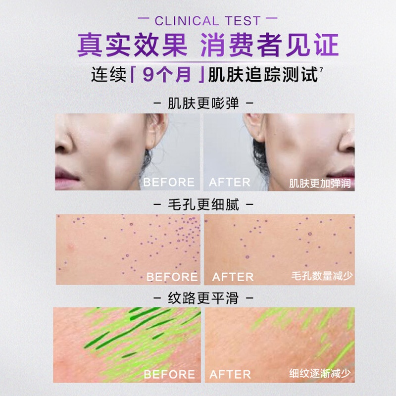 商品[国内直发] L'Oreal Paris|欧莱雅第三代黑精华抗初老精华液补水保湿抗皱紧致15ml*3支（旅行装）,价格¥66,第3张图片详细描述