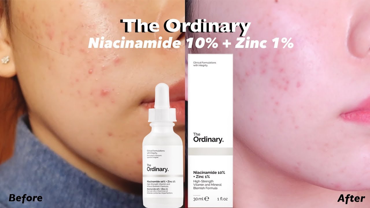 商品The Ordinary|10%烟酰胺+1%锌精华液 30ml,价格¥53,第10张图片详细描述