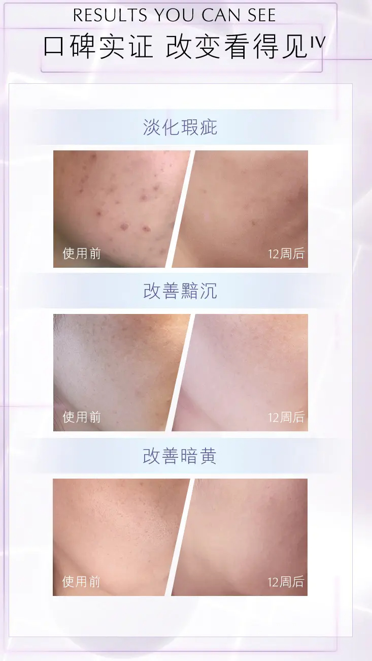 商品Estée Lauder|雅诗兰黛面部肌光精华50ml/100ml淡化瑕疵提亮肤色【香港直邮】,价格¥481,第5张图片详细描述