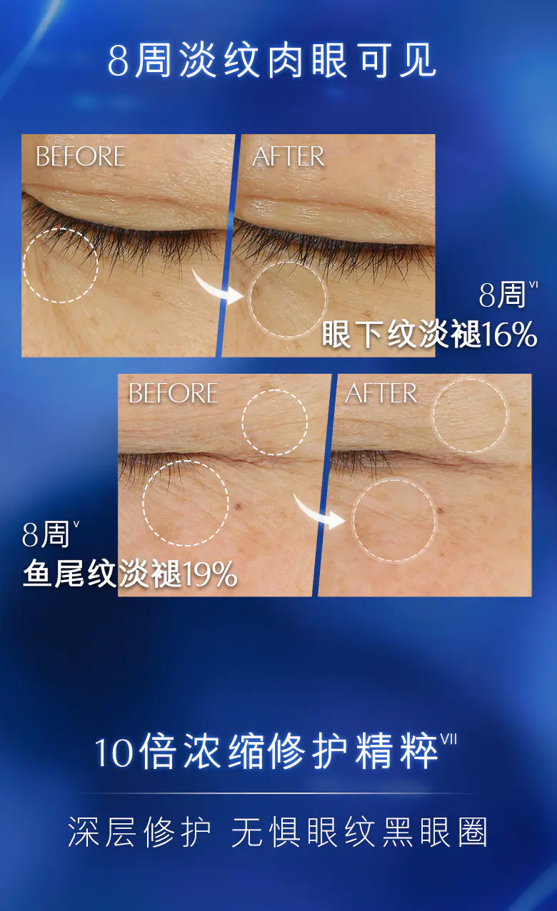 商品Estée Lauder|雅诗兰黛第五代小棕瓶抗蓝光眼霜15ml*2瓶淡化黑眼圈紧致眼周【香港直邮】Advanced Night Repair Overnight Treatment,价格¥343,第5张图片详细描述