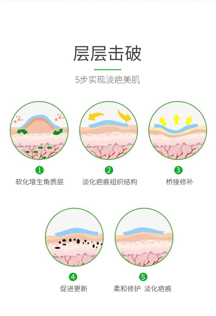 商品Hisamitsu|瑞典进口美皮护Mepiform巴痕贴增生伤疤贴双眼皮疤修复巴痕膏痘印硅酮剖腹产增生巴痕贴 4x30cm ,价格¥100,第4张图片详细描述