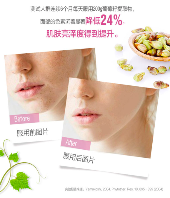 商品Swisse|葡萄籽精华片 300粒,价格¥210,第9张图片详细描述