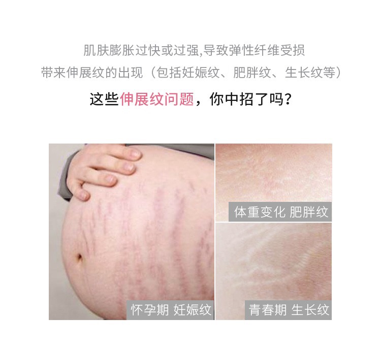 商品Lierac|LIERAC丽蕾克淡纹修护安瓶精华5mlx20 防祛肥胖纹妊娠纹,价格¥159,第3张图片详细描述