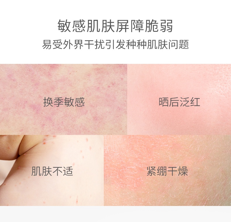 商品Avene|雅漾舒护活泉喷雾补水舒缓修复敏感肌大喷300ml,价格¥98,第2张图片详细描述