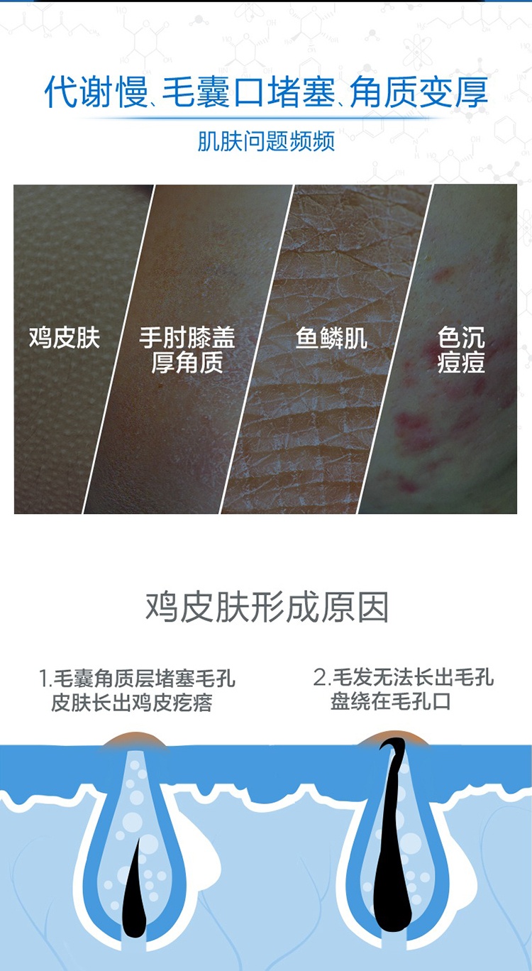 商品NeoStrata|NeoStrata芯丝翠倍舒15%AHA果酸身体乳200ml 刷酸修护,价格¥337,第8张图片详细描述