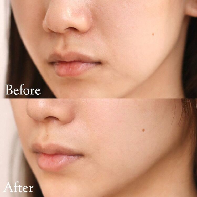 商品[国内直发] L'Oreal Paris|欧莱雅青春密码酵素精华肌底液套装,价格¥375,第17张图片详细描述