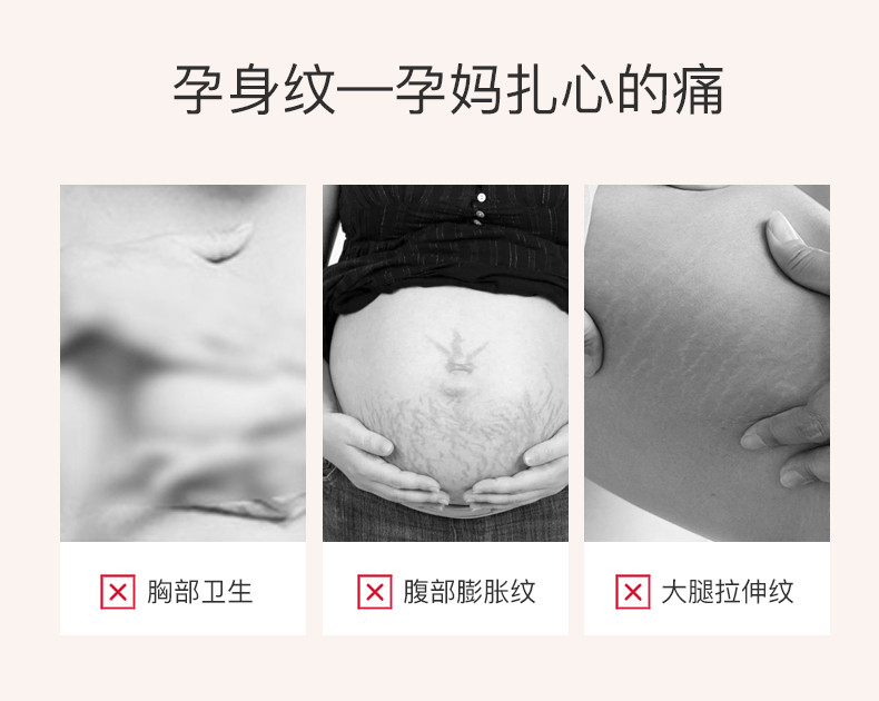 商品Clarins|Clarins娇韵诗孕妇妊娠纹身体护理抚纹霜磨砂膏三件套,价格¥821,第3张图片详细描述