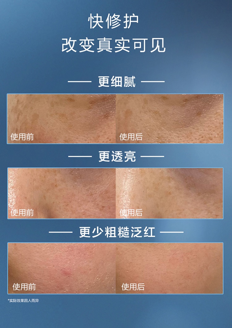 商品Lancôme|兰蔻小黑瓶精华套装4件套 精华+素颜日霜+素颜晚霜+眼霜,价格¥874,第8张图片详细描述