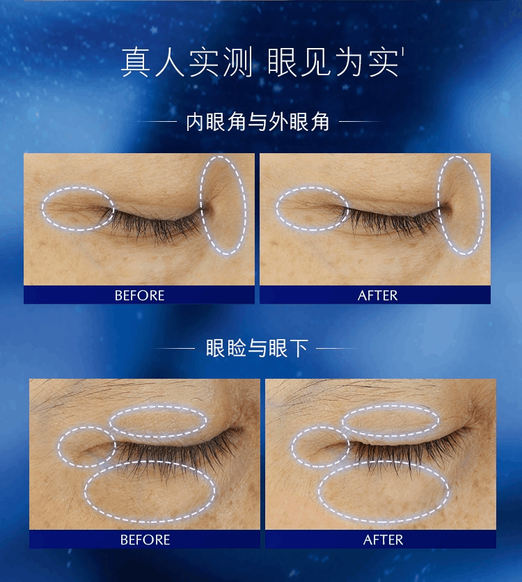 商品Estée Lauder|雅诗兰黛（Estee Lauder）特润修护精华眼霜熬夜眼霜 小棕瓶眼霜 15ml,价格¥183,第10张图片详细描述