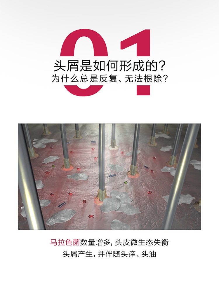 商品René Furterer|馥绿德雅去屑洗发水150ml止痒控油 油性头皮适用,价格¥164,第4张图片详细描述