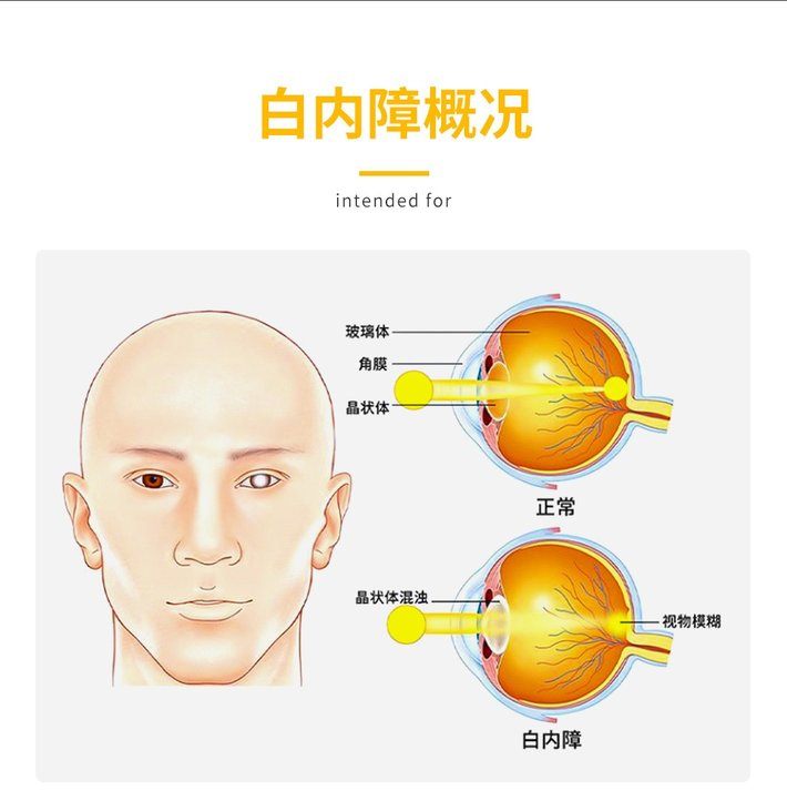 商品Hisamitsu|�日本进口原装老人白内障眼药水武田千寿老人眼药水武田制药老人老年眼病眼药水滴眼液老年 1盒(10支) 15ml,价格¥41,第5张图片详细描述