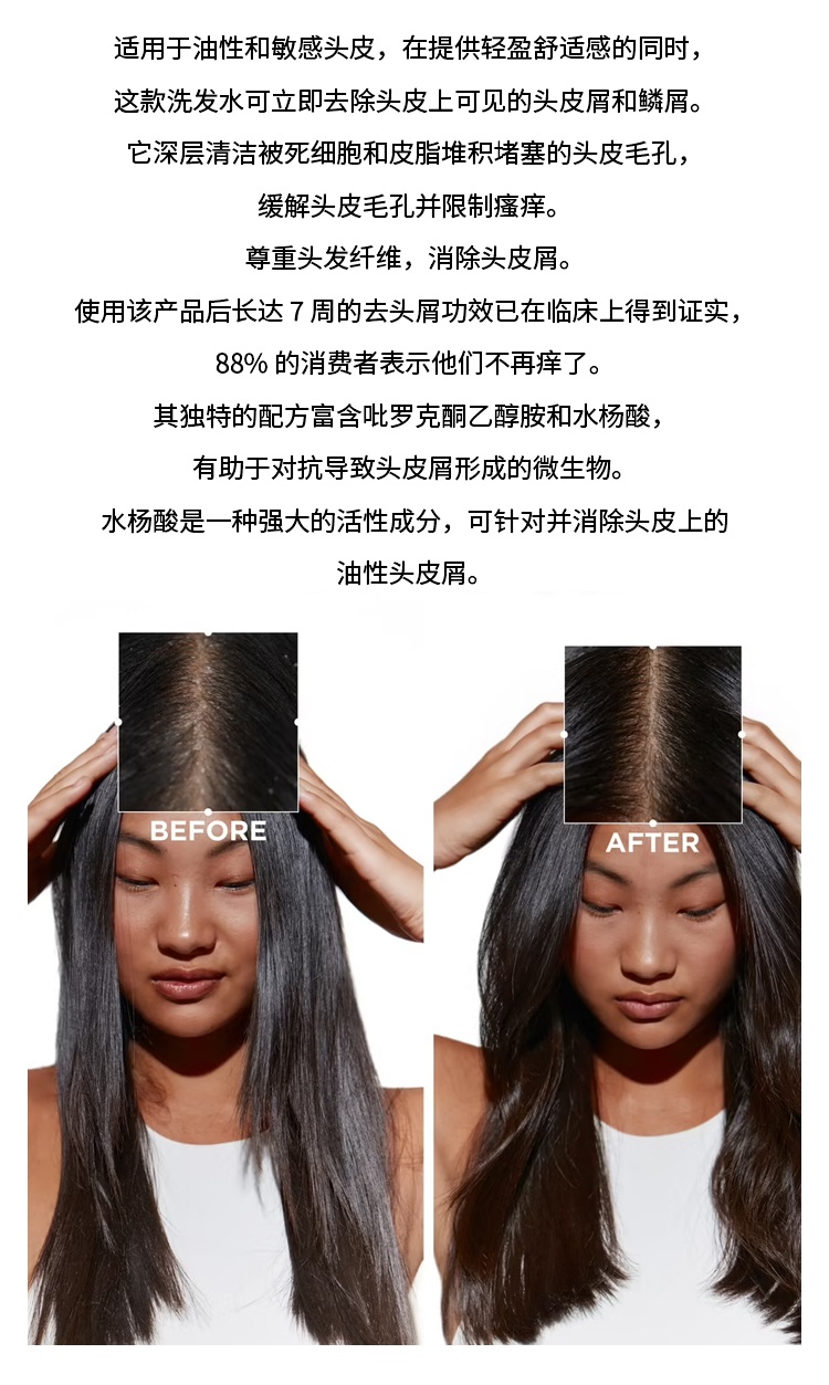 商品Kérastase|卡诗SYMBIOSE自在系列去头皮屑清爽洗发水 250ml,价格¥231,第3张图片详细描述