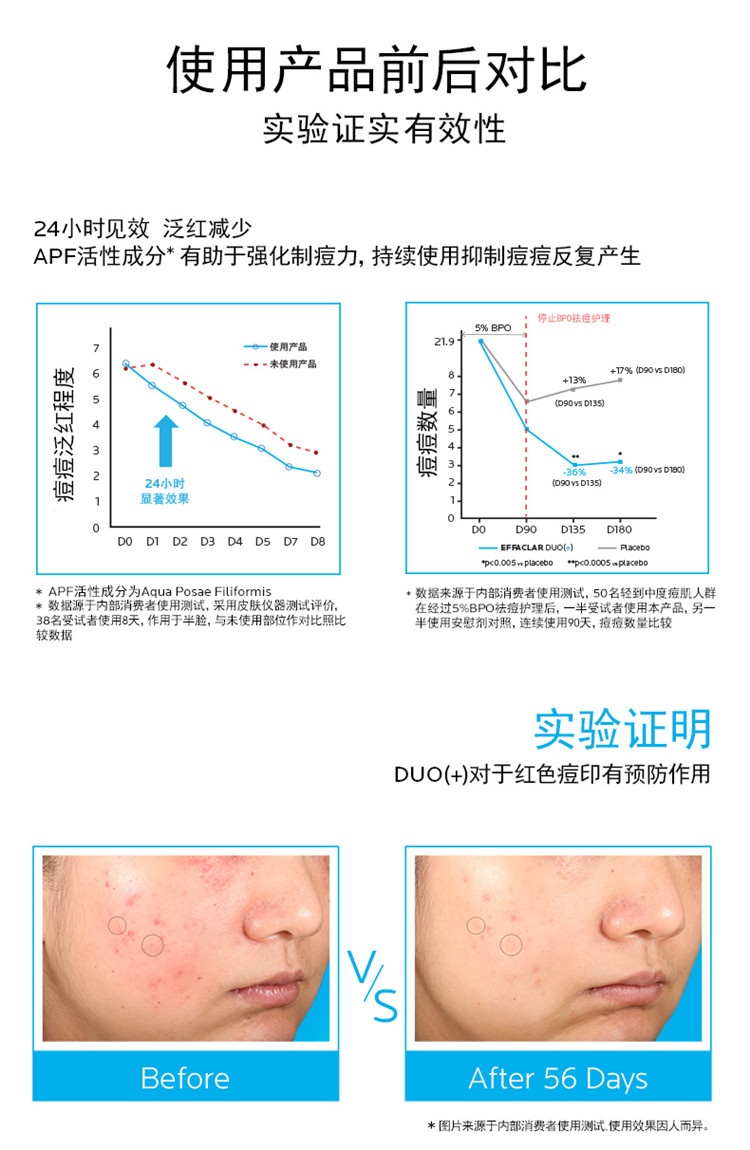 商品La Roche Posay|LA ROCHE-POSAY理肤泉 青春痘调理精华乳40ML,价格¥178,第6张图片详细描述