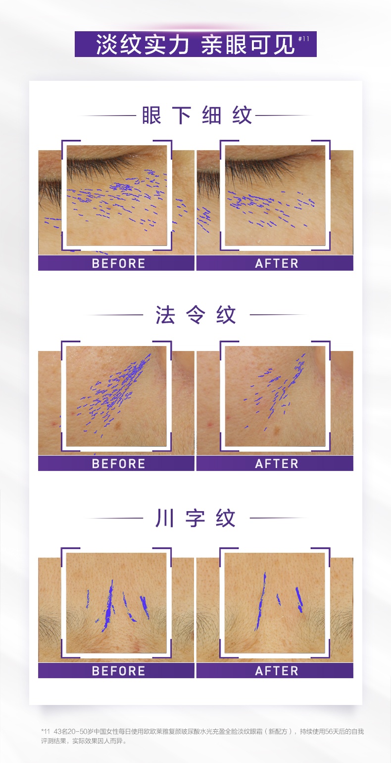 商品[国内直发] L'Oreal Paris|欧莱雅玻尿酸全新玻色因PRO紫熨斗全脸眼霜(第二代)按摩头30ml赠7.5ml*4支,价格¥288,第7张图片详细描述
