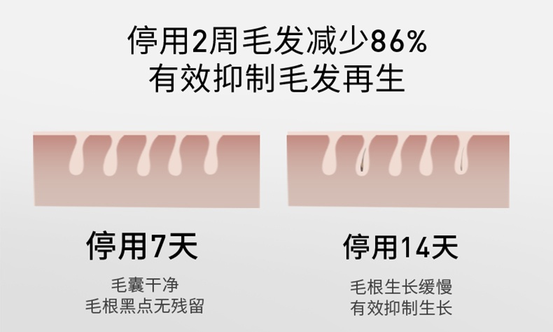 商品Ulike|【国行正品 国内直发】Ulike蓝宝石冰点脱毛仪Air3唇部家用医用持久海茶色,价格¥2645,第8张图片详细描述
