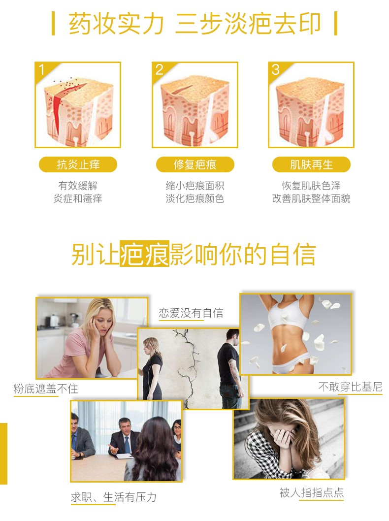 商品Contractubex|德国原版进口Contractubex秀碧袪疤膏修复除疤膏凝胶去疤膏,价格¥170,第17张图片详细描述