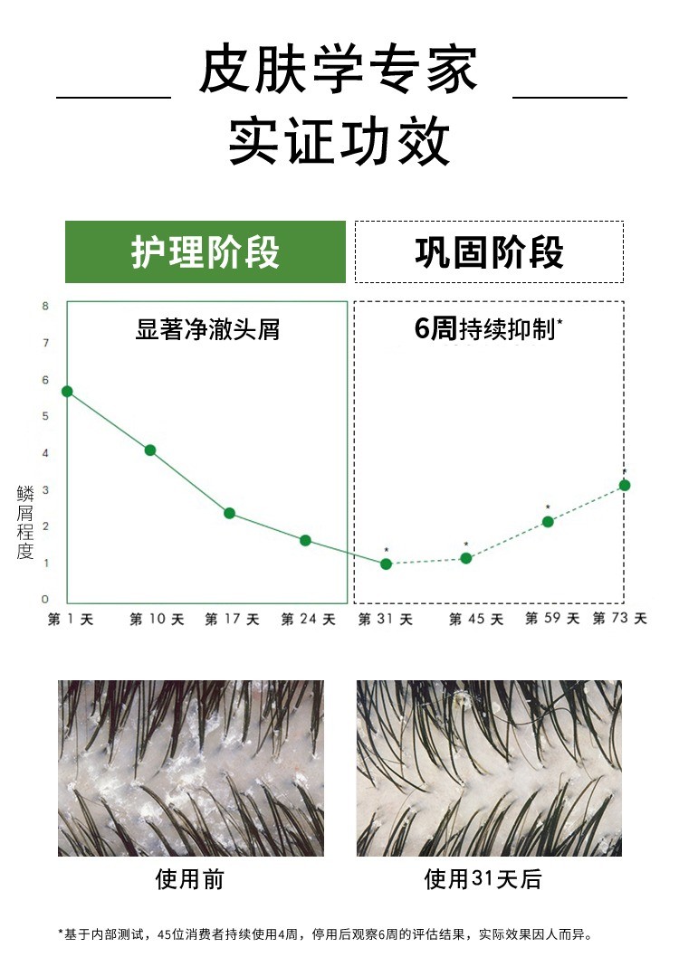 商品Vichy|Vichy薇姿DERCOS绿标洗发水390mlx2 去屑控油止痒,价格¥291,第5张图片详细描述