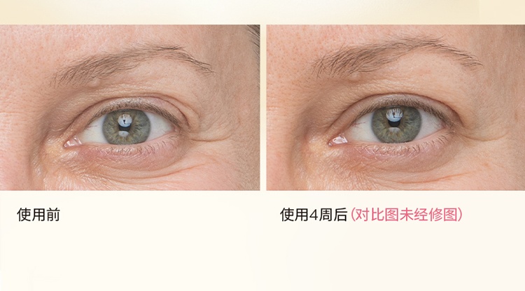 商品IT Cosmetics|IT COSMETICS依科美 自信眼霜15ml 淡化细纹,价格¥316,第3张图片详细描述