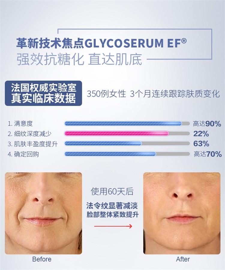 商品Biocyte|Biocyte碧维斯特抗糖丸30-90粒,价格¥286,第7张图片详细描述