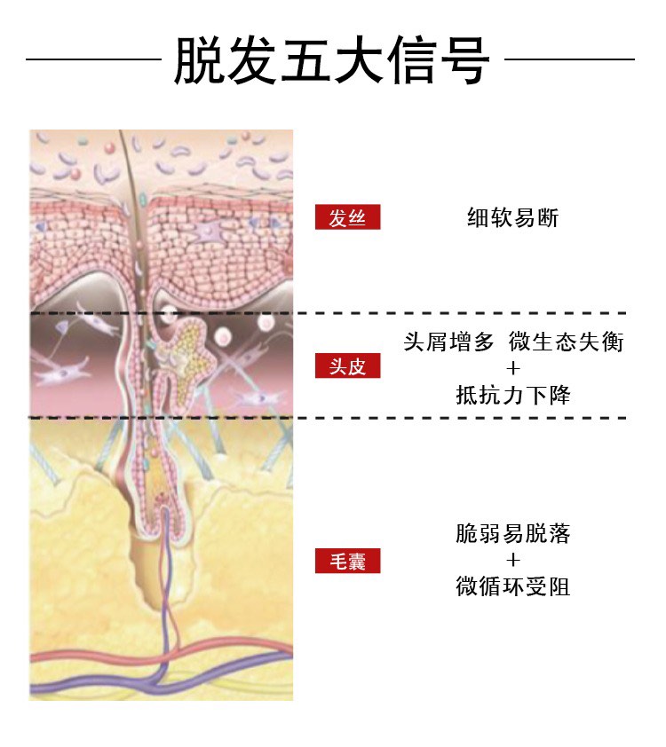 商品Vichy|Vichy薇姿DERCOS防脱固发头皮护理安瓶精华液6mlx21 男版,价格¥436,第4张图片详细描述