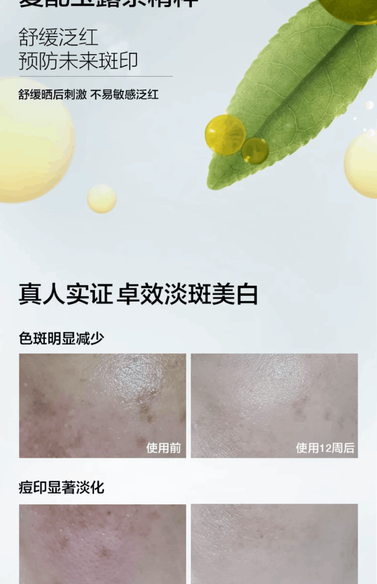 商品Clinique|倩碧302美白镭射瓶匀净淡斑多效精华液 30/50/100ml 淡斑去印提亮肤色,价格¥218,第6张图片详细描述