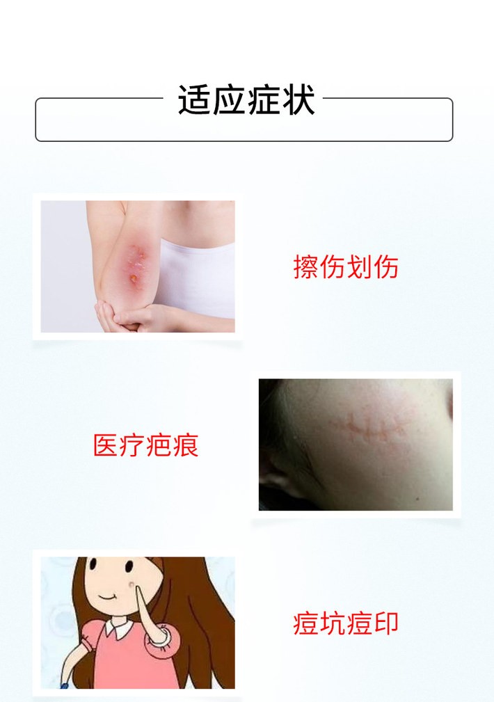 商品Hisamitsu|日本MSD祛疤膏 凝胶祛疤膏 术后疤痕袪凹凸疤淡化脸部疤痕成人儿童祛除痘印刀疤修复疤痕 高田祛疤膏,价格¥52,第2张图片详细描述