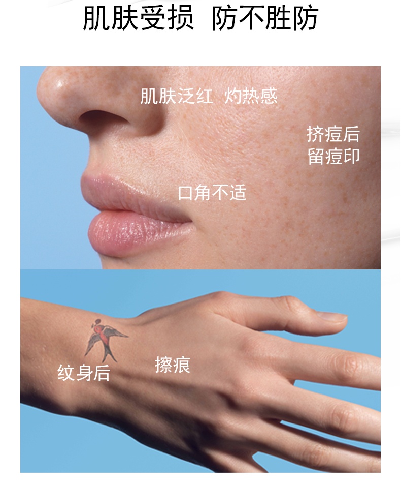 商品[国内直发] La Roche Posay|【100ml】法国理肤泉B5多效舒缓修复面霜 淡化痘印修护敏感肌 100ml,价格¥159,第4张图片详细描述