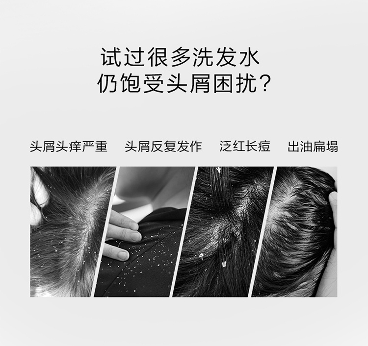 商品René Furterer|馥绿德雅去屑洗发水150ml止痒控油 油性头皮适用,价格¥164,第3张图片详细描述