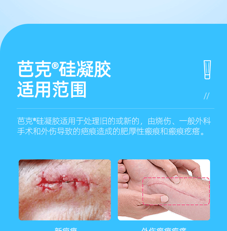 商品Kelo-cote|国疤克进口巴克辅助祛疤疤痕修复膏去疤凝胶,价格¥239,第3张图片详细描述
