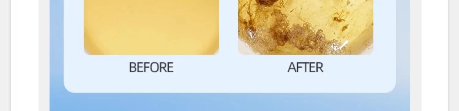 商品[国内直发] Okuchi|Okuchi便携快速漱口水5支-除菌防口臭异味,价格¥16,第9张图片详细描述