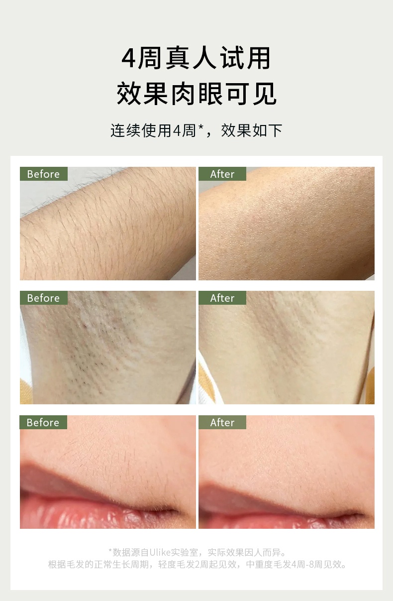 商品Julius|Ulike蓝宝石air冰点激光脱毛仪器家用全身剃毛刮毛脱毛机,价格¥2770,第2张图片详细描述