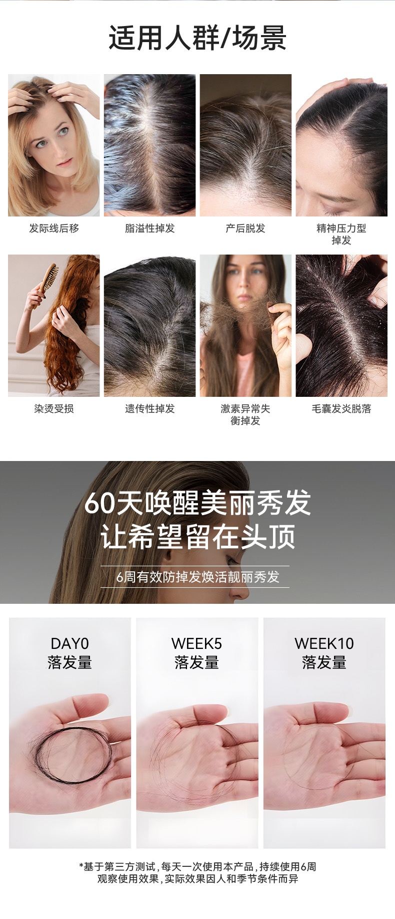 商品[国内直发] TIME NATURE| 元岁荣养 美发守护者 唤醒美丽秀发 打造浓密发际线,价格¥376,第6张图片详细描述