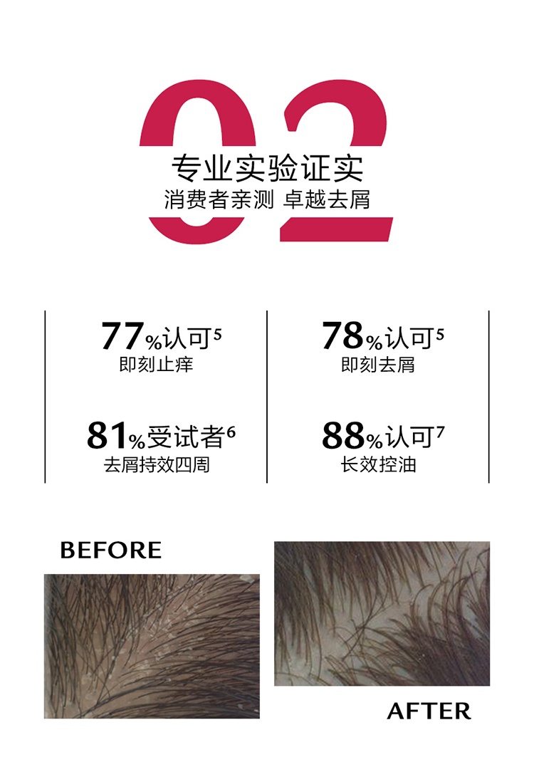 商品René Furterer|馥绿德雅去屑洗发水150ml止痒控油 油性头皮适用,价格¥164,第5张图片详细描述