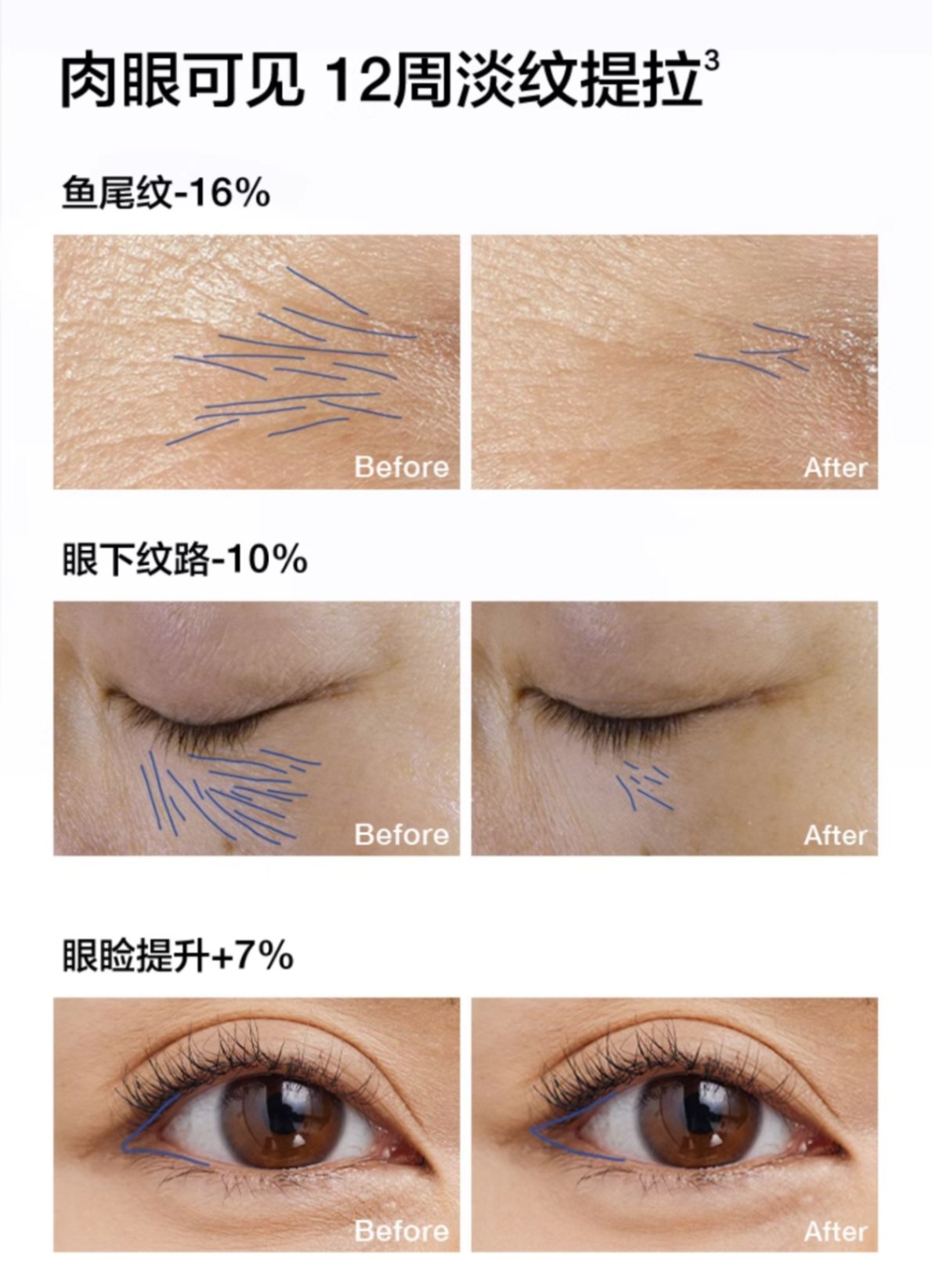 商品Clinique|CLINIQUE 倩碧 智慧专研抚纹眼霜1870紫光眼霜 15ml 抗皱淡纹紧致抗衰,价格¥315,第7张图片详细描述