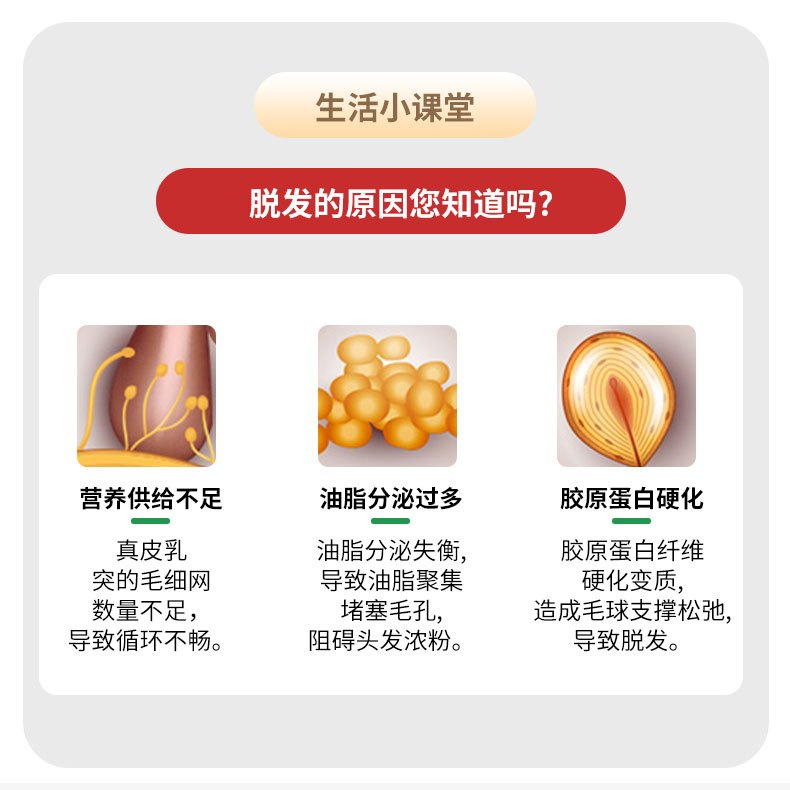 商品Hisamitsu|日本长生堂JG生发液治疗脱发症防脱生发增发密发固发水脱发营养液,价格¥104,第2张图片详细描述