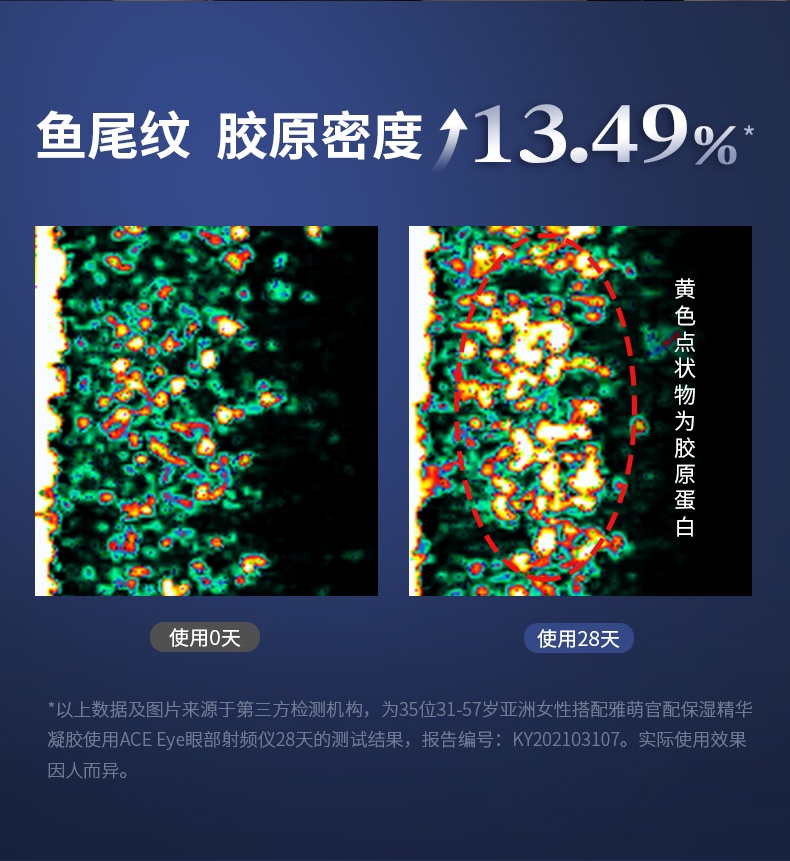 商品[国内直发] YA-MAN|雅萌ACE Eye眼部射频美容仪提拉眼周美眼仪,价格¥2529,第11张图片详细描述