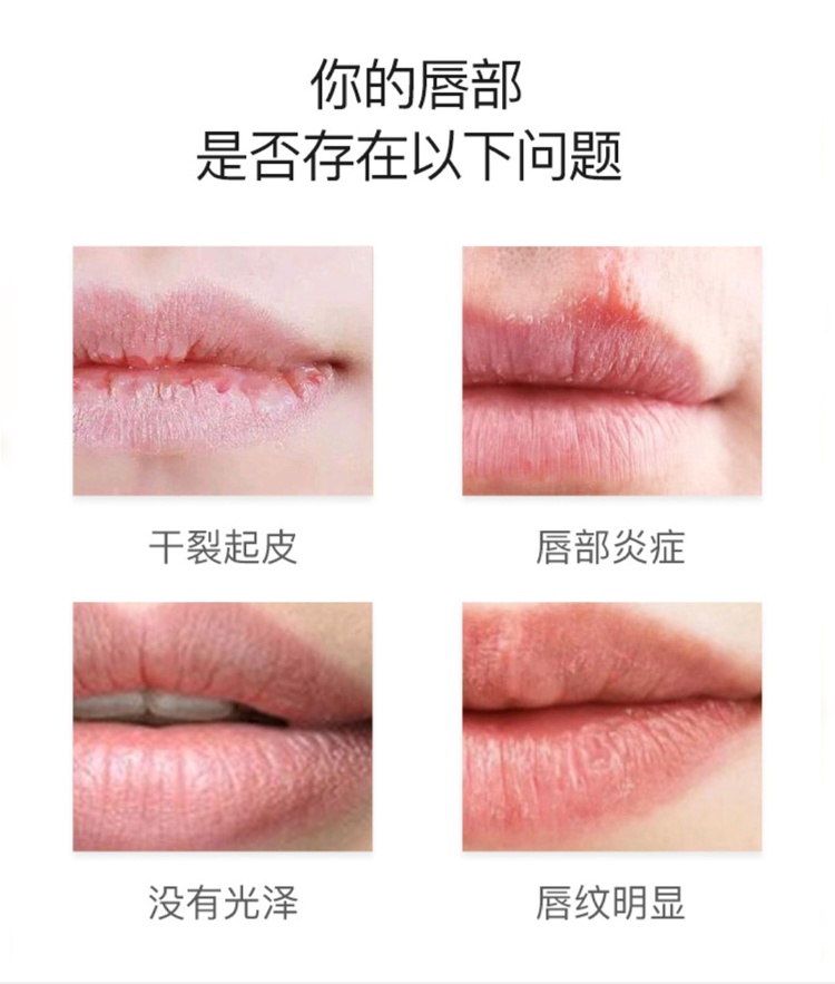 商品Shiseido|SHISEIDO/资生堂MOILIP修护润唇膏8g,价格¥56,第2张图片详细描述