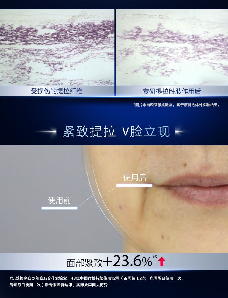 商品L'Oreal Paris|L'oreal 欧莱雅 A醇精华复颜精纯视黄醇夜精华露 30ml 补水保湿淡化细纹,价格¥317,第11张图片详细描述