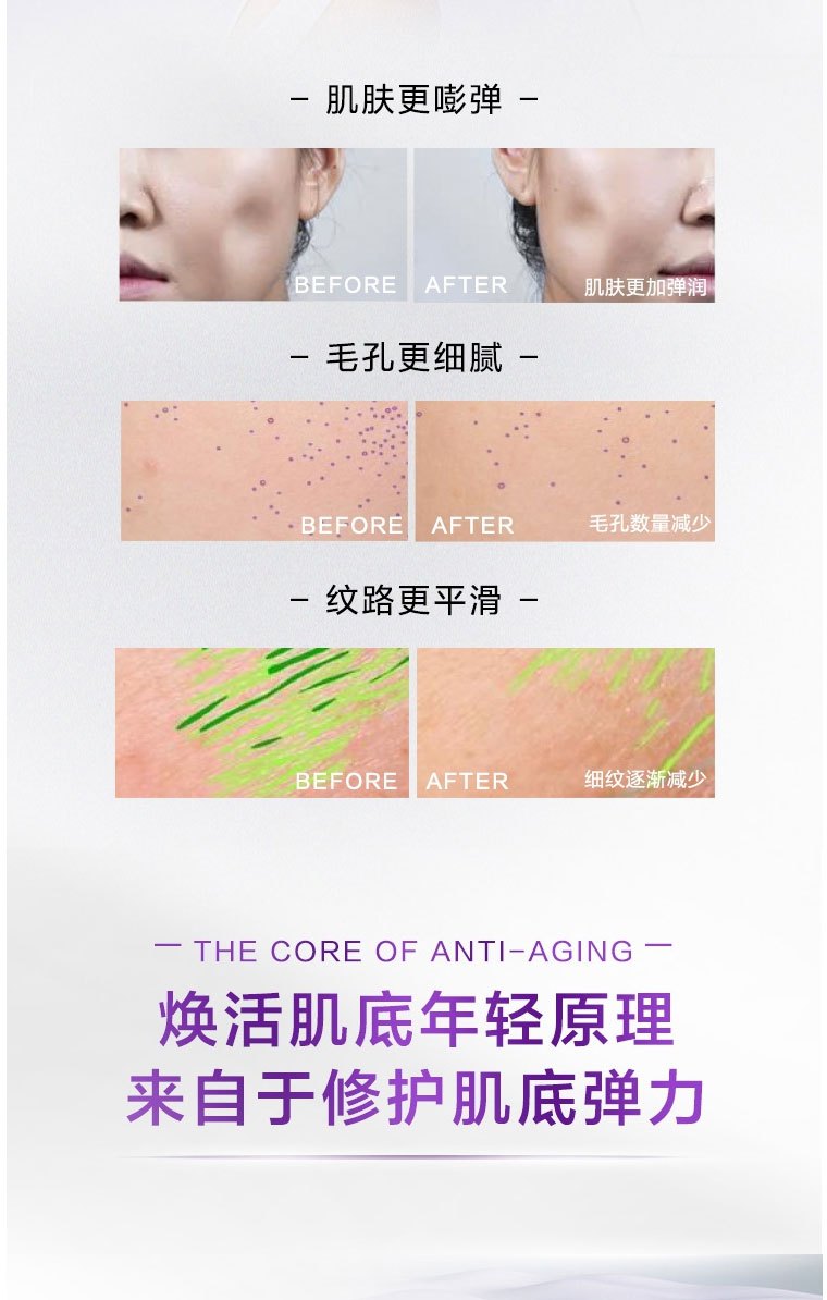 商品L'Oreal Paris|欧莱雅 第三代黑精华小黑瓶青春密码酵素精华肌底液75ml,价格¥176,第5张图片详细描述