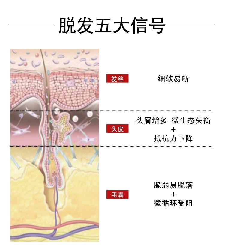商品Vichy|Vichy薇姿DERCOS丝头皮修护女士多效丰盈精华液6mlx21 女版,价格¥434,第3张图片详细描述
