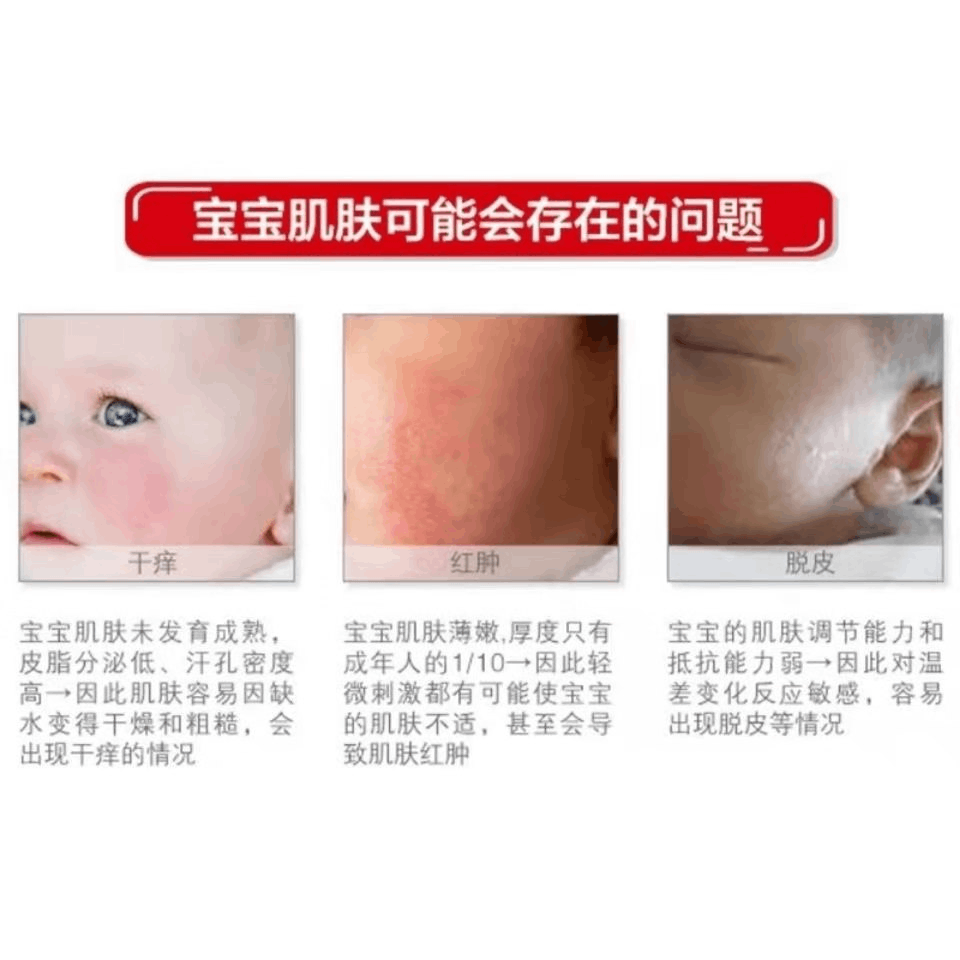 商品Winona|薇诺娜宝贝舒润霜100g/200g婴幼儿宝宝专用保湿霜改善皮肤干燥,价格¥103,第4张图片详细描述