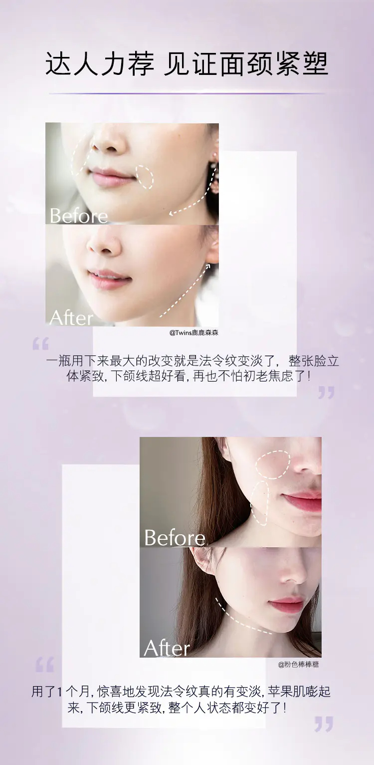 商品Estée Lauder|雅诗兰黛专研紧塑线雕精华素30ml/50ml/100ml提拉紧致淡纹抗老【香港直邮】,价格¥291,第7张图片详细描述