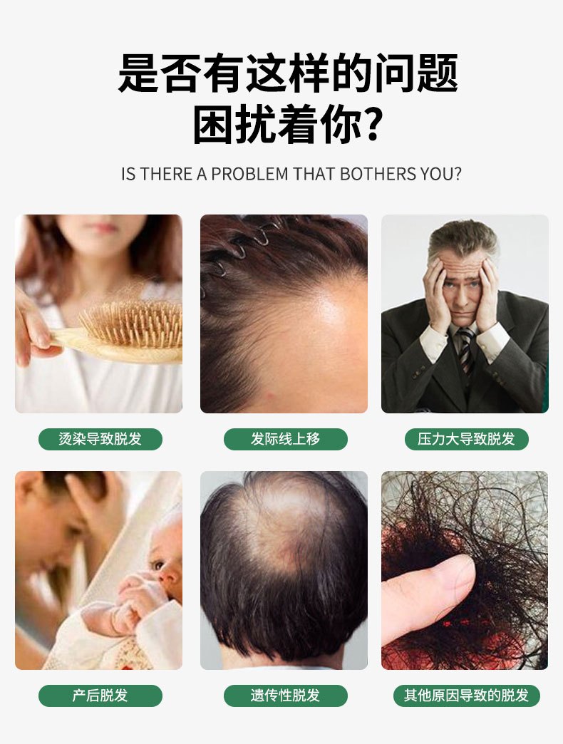 商品Hisamitsu|日本长生堂JG生发液治疗脱发症防脱生发增发密发固发水脱发营养液,价格¥104,第3张图片详细描述
