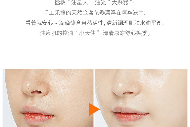 商品Kiehl's|Kiehl's 科颜氏 金盏花爽肤水250ml,价格¥340,第8张图片详细描述